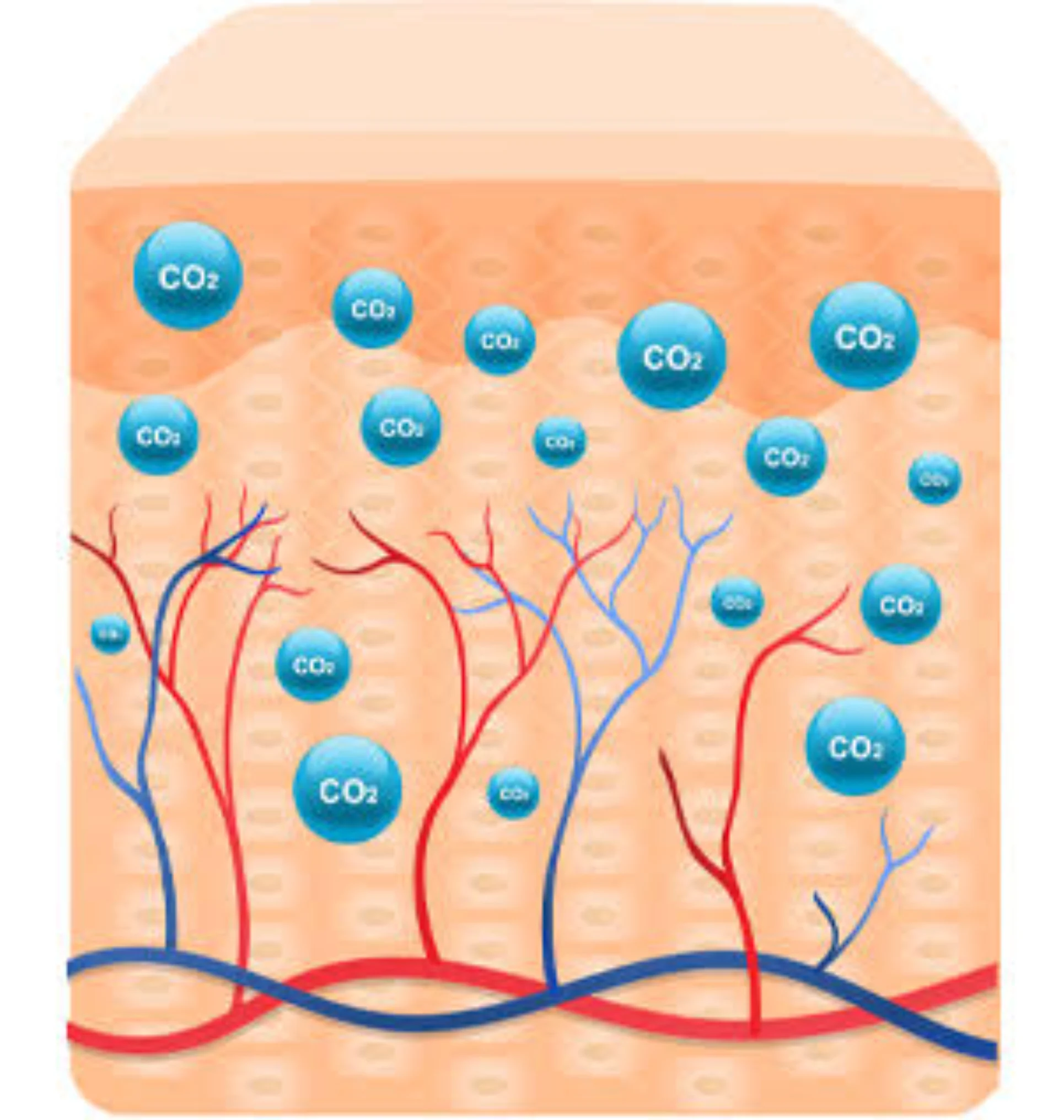 CO2 Lift V Park City